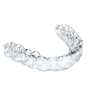 Digital (Impression Free) Retainers